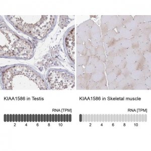 Anti-KIAA1586 antibody produced in rabbit 