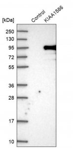 Anti-KIAA1586 antibody produced in rabbit 