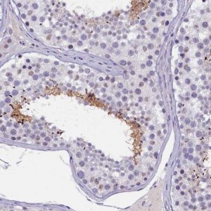 Anti-KIAA1683 antibody produced in rabbit 