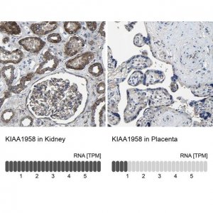Anti-KIAA1958 antibody produced in rabbit 