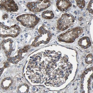 Anti-KIAA1958 antibody produced in rabbit 