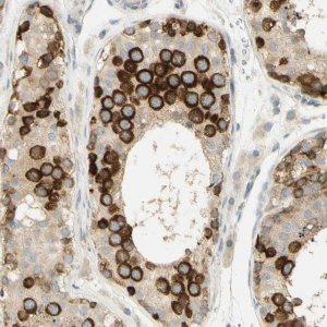 Anti-KIF11 antibody produced in rabbit 