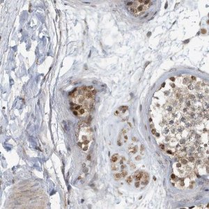 Anti-KIF15 antibody produced in rabbit 