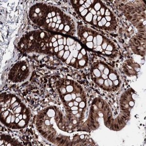 Anti-KIF18A antibody produced in rabbit 