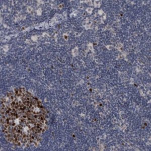 Anti-KIF18B antibody produced in rabbit 