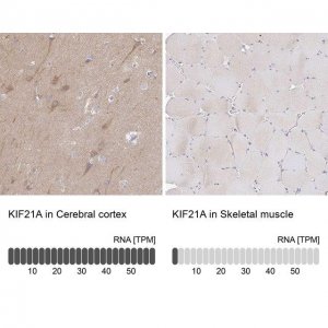 Anti-KIF21A antibody produced in rabbit 