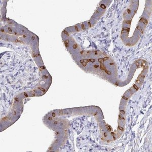 Anti-KIF21A antibody produced in rabbit 