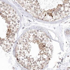 Anti-KIF2B antibody produced in rabbit 