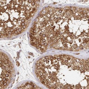 Anti-KIF5B antibody produced in rabbit HPA037589-100UL