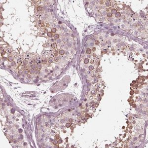 Anti-KIF6 antibody produced in rabbit 