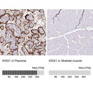 Anti-KISS1 antibody produced in rabbit 