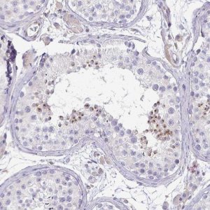 Anti-KISS1 antibody produced in rabbit 