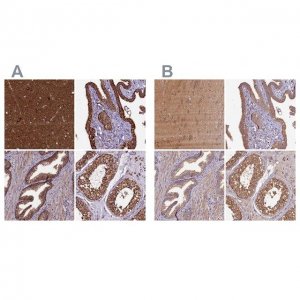 Anti-KLC2 antibody produced in rabbit 
