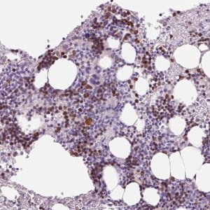 Anti-KLF1 antibody produced in rabbit 