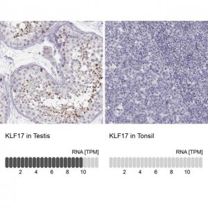 Anti-KLF17 antibody produced in rabbit 