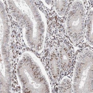 Anti-KLF7 antibody produced in rabbit 