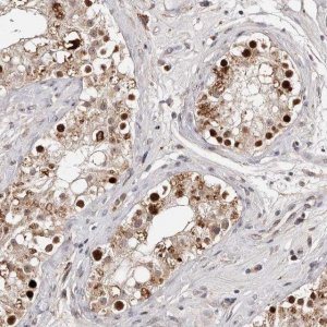 Anti-KLF7 antibody produced in rabbit 