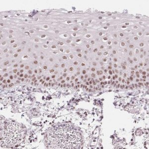 Anti-KLHDC9 antibody produced in rabbit 