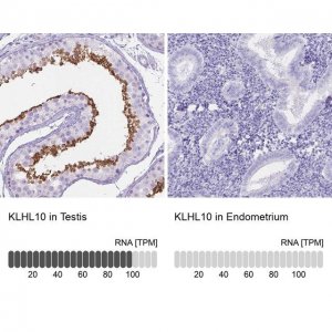 Anti-KLHL10 antibody produced in rabbit 