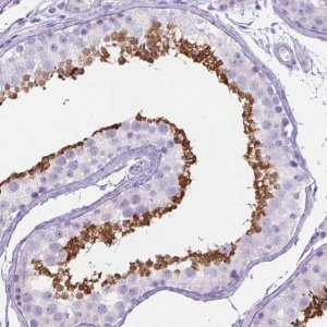 Anti-KLHL10 antibody produced in rabbit 