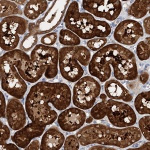 Anti-KLHL25 antibody produced in rabbit 