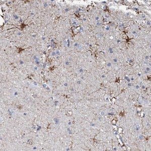 Anti-KLHL32 antibody produced in rabbit 