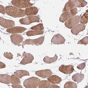 Anti-KLHL40 antibody produced in rabbit 