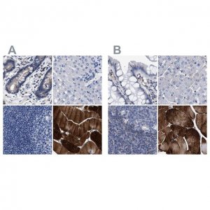 Anti-KLHL41 antibody produced in rabbit 