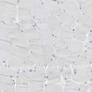 Anti-KLK5 antibody produced in rabbit 
