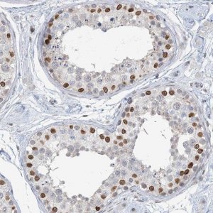 Anti-KMT2D antibody produced in rabbit 