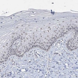 Anti-KMT2D antibody produced in rabbit 