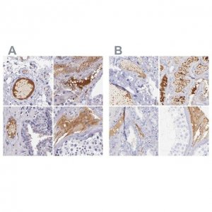 Anti-KNG1 antibody produced in rabbit 