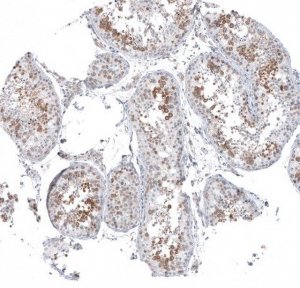 Anti-KNSTRN antibody produced in rabbit 