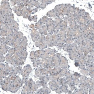 Anti-KNSTRN antibody produced in rabbit 