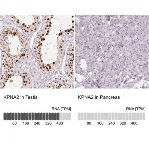 Anti-KPNA2 antibody produced in rabbit 