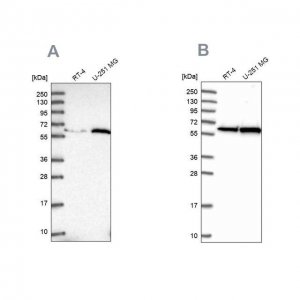 Anti-KPNA4 antibody produced in rabbit HPA045500-100UL
