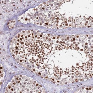 Anti-KPNA4 antibody produced in rabbit HPA045500-100UL