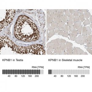 Anti-KPNB1 antibody produced in rabbit HPA029878-100UL