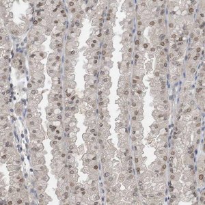 Anti-KPNB1 antibody produced in rabbit HPA029878-100UL