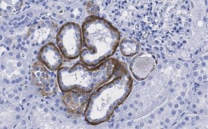 Anti-KRas Antibody, clone 2J13, ZooMAb Rabbit Monoclonal 