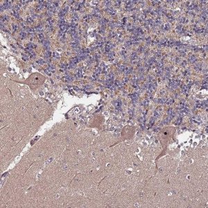 Anti-KRI1 antibody produced in rabbit 