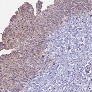 Anti-KRR1 antibody produced in rabbit 