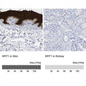 Anti-KRT1 antibody produced in rabbit 