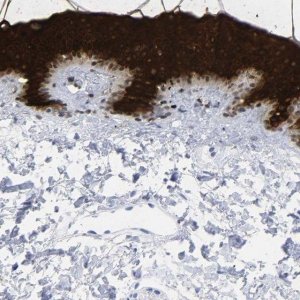 Anti-KRT1 antibody produced in rabbit 