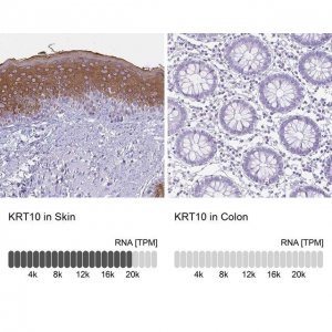 Anti-KRT10 antibody produced in rabbit 