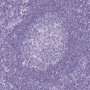 Anti-KRT10 antibody produced in rabbit 