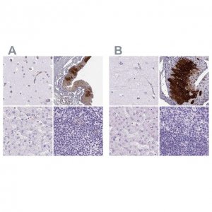 Anti-KRT12 antibody produced in rabbit 