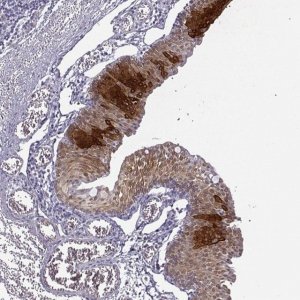 Anti-KRT12 antibody produced in rabbit 