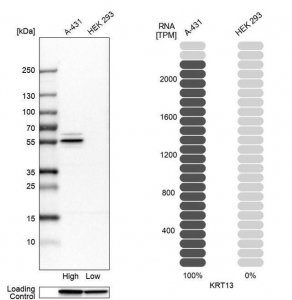 Anti-KRT13 antibody produced in rabbit 