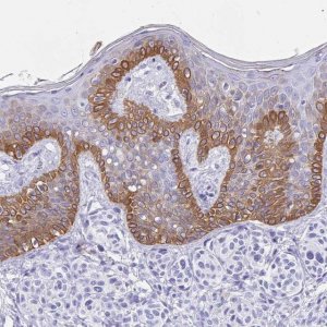 Anti-KRT13 antibody produced in rabbit 